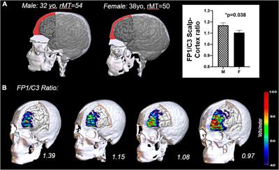 Sex/Gender as a Factor That Influences Transcranial Magnetic Stimulation Treatment Outcome: Three Potential Biological Explanations